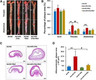 Ginsenoside Rb2 Alleviated Atherosclerosis by Inhibiting M1 Macrophages Polarization Induced by MicroRNA-216a